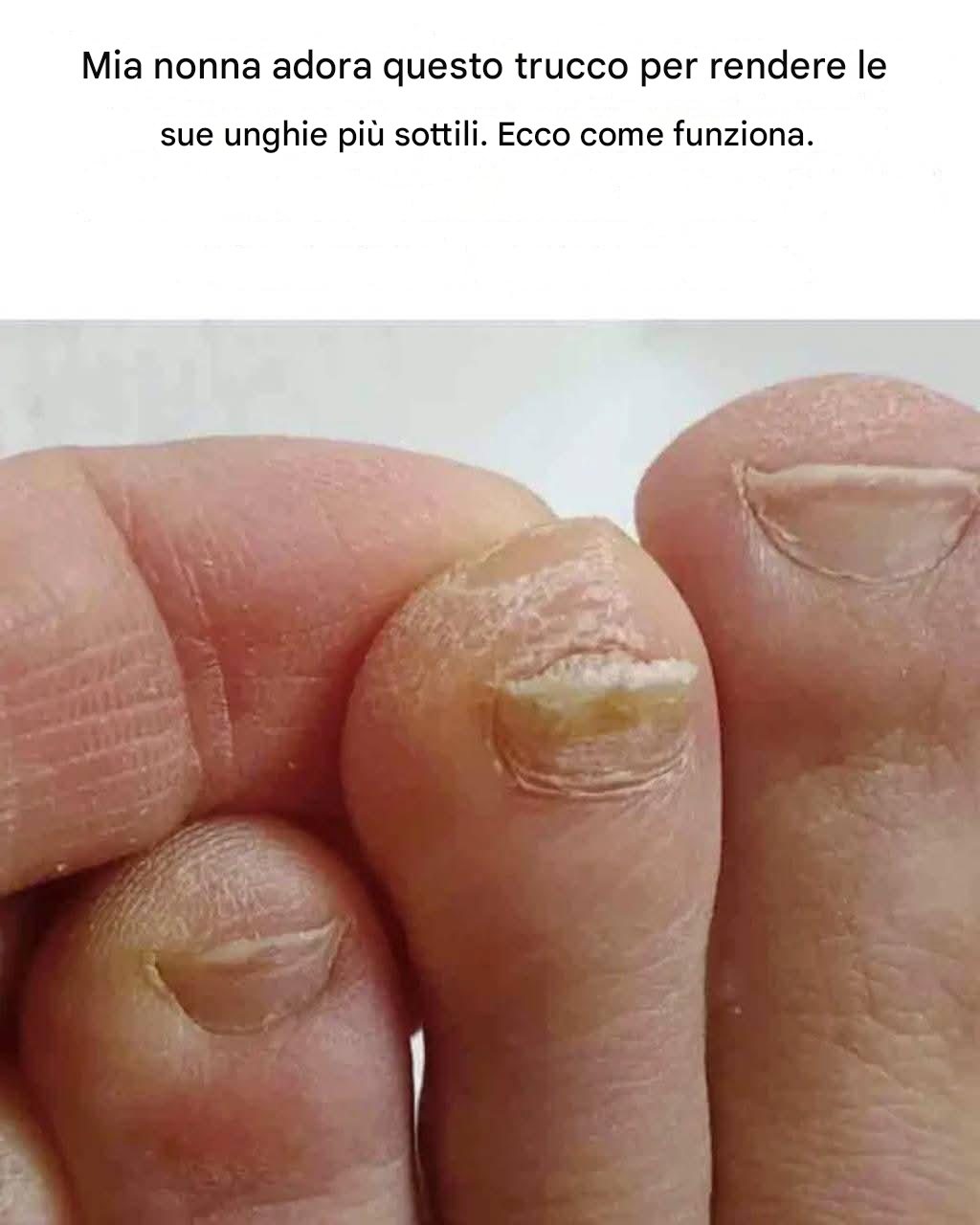 Mia nonna adora questo trucco per rendere le sue unghie più sottili. Ecco come funziona.