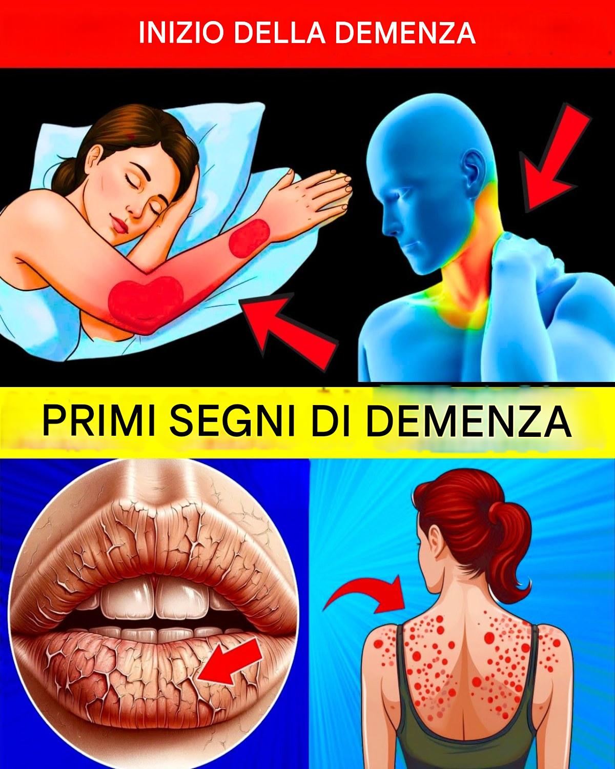 10 segnali precoci di demenza da NON ignorare MAI!
