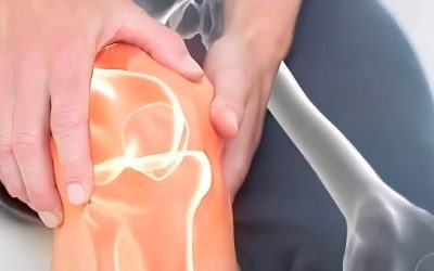 Neoplasia al pancreas i 4 campanelli d’allarme sulle gambe da non sottovalutare (1 / 2)