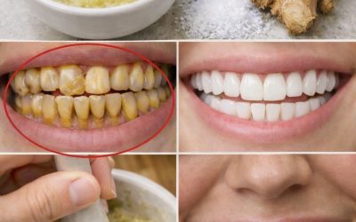 Zenzero e sale per denti più bianchi: un delicato trucco naturale o solo l’ennesima moda?