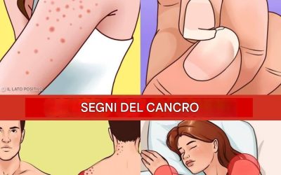 12 segnali premonitori che indicano che il tuo corpo sta sviluppando cellule cancerose