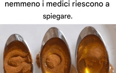 Cannella e miele: il rimedio più efficace che nemmeno i medici riescono a spiegare.