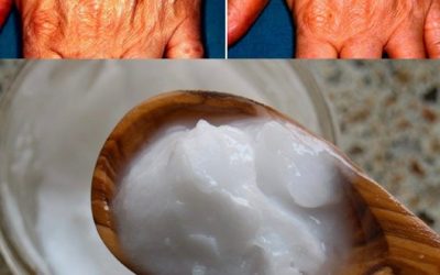 La mia crema fatta in casa è la più potente per ringiovanire le mani, contro rughe e macchie della pelle. La preparo in 5 minuti e la tengo in posa per