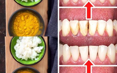 Come rimuovere tartaro e placca senza il dentista: curcuma e sale