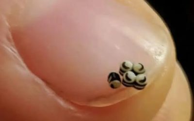 Abbiamo ordinato un’insalata, ma c’erano delle piccole macchie nere nel cibo: siamo andati subito in ospedale