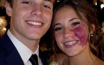 Solo un ragazzo mi ha chiesto di andare al ballo perché nessun altro voleva a causa della voglia sul mio viso – tutti ridevano finché un agente non è entrato nella sala