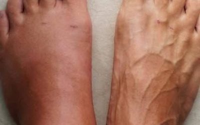 Un mese prima di un attacco di cuore, il tuo corpo diffonde 7 pericolose minacce per te