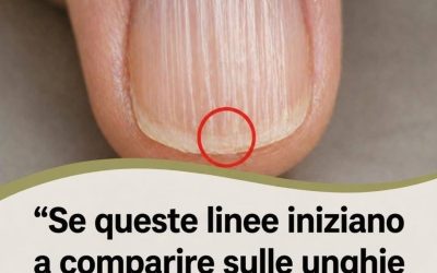 Perché compaiono le creste verticali sulle unghie dopo i 40 anni? Ecco la verità. inno