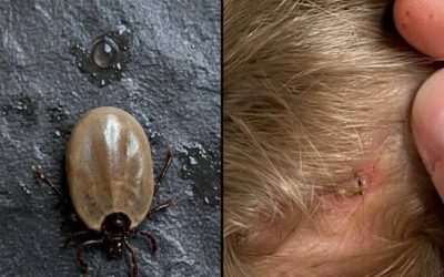 🐛😨Qualcuno sa che tipo di insetto è questo? L’ho trovato sulla testa di mio figlio…👦🔍Una scoperta inquietante che ha subito scatenato numerose reazioni😮⚠️E voi, sapete che tipo di insetto potrebbe essere?🤔👇Ditecelo nei commenti💬