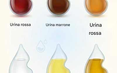 Cosa dice il colore della tua urina sulla tua salute?