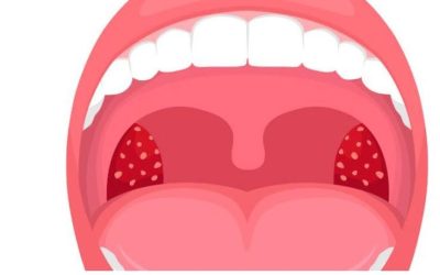Bocca secca al risveglio: un segnale che potrebbe rivelare più di quanto immagini sulla tua salute.